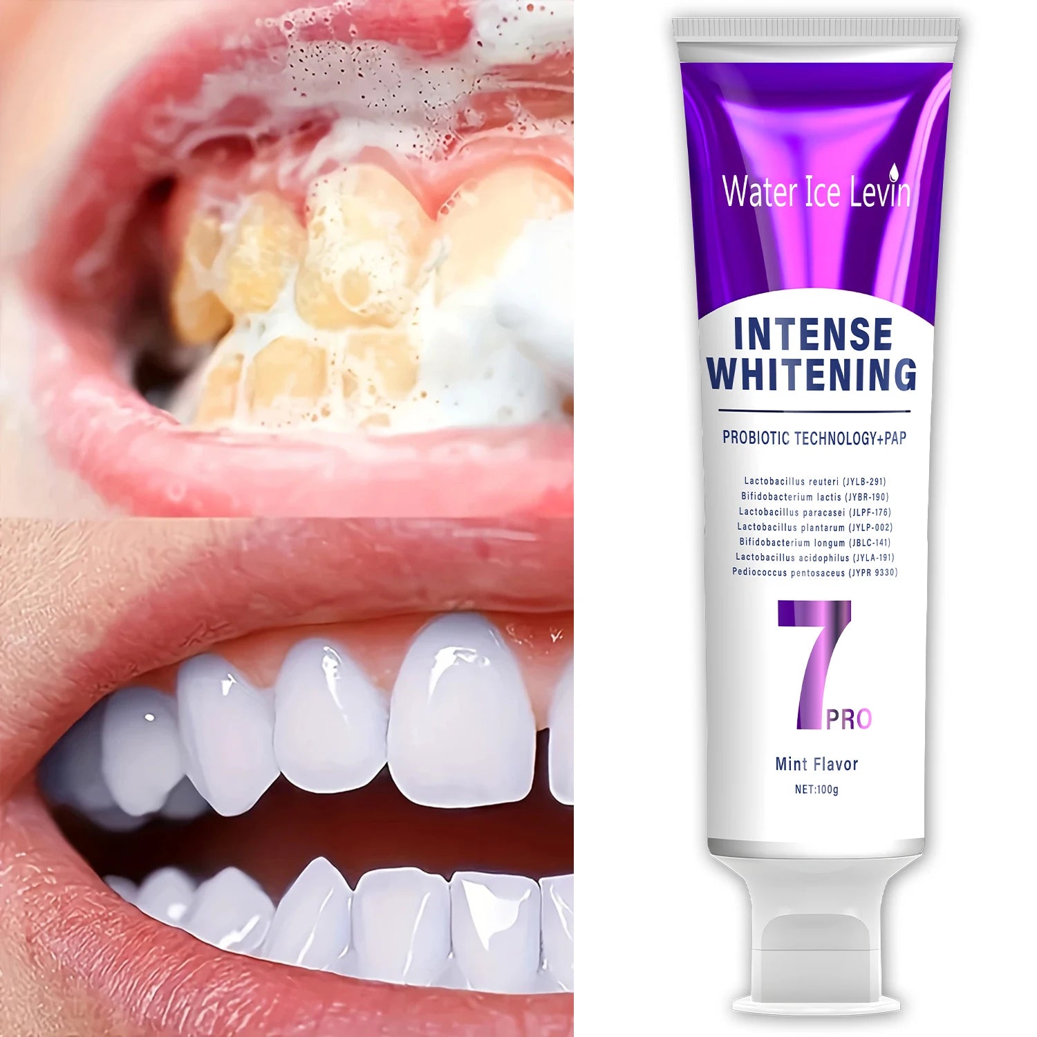Elevate Your Oral Care Routine with Probiotic Whitening Toothpaste - Fresh Breath & Healthy Gums for the Whole Family